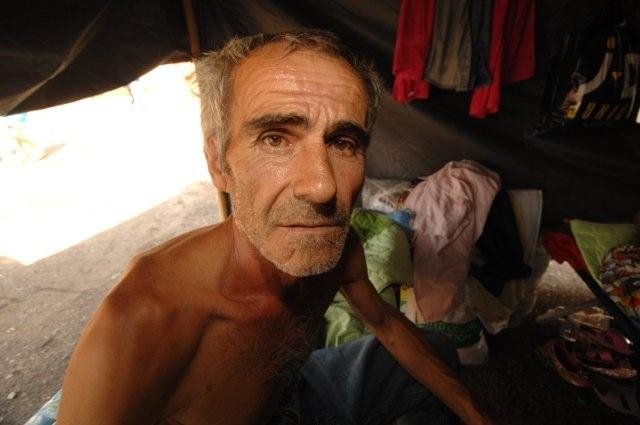 An unfortunate man - Lilo IDP Camp - August 2008